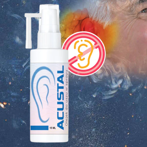 Acustal - Image 5