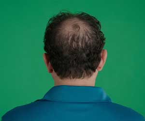 Hair Grow Max 2x1 a 214 PLN - Image 11