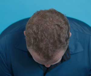 Hair Grow Max 2x1 a 214 PLN - Image 12