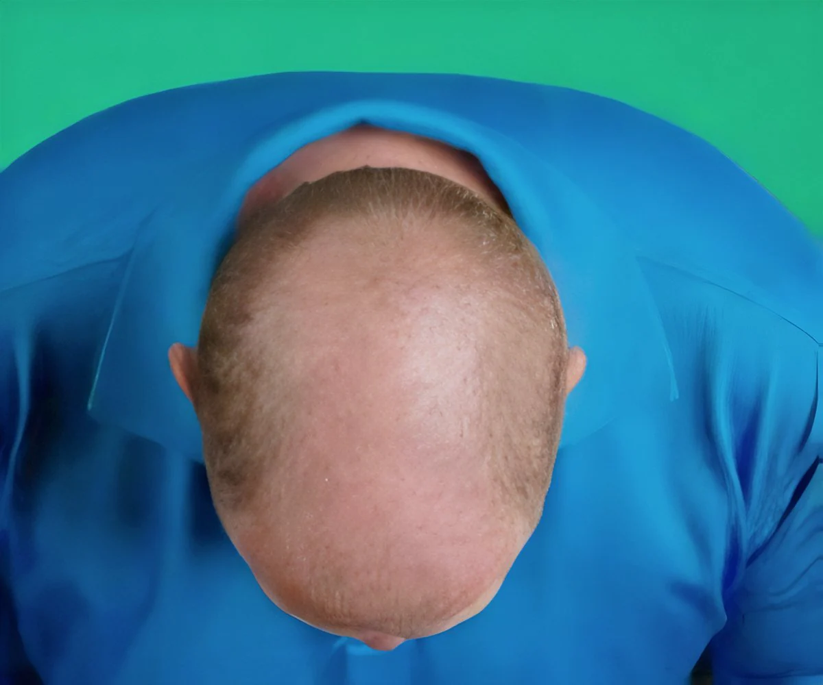Hair Grow Max 2x1 a 214 PLN - Image 6